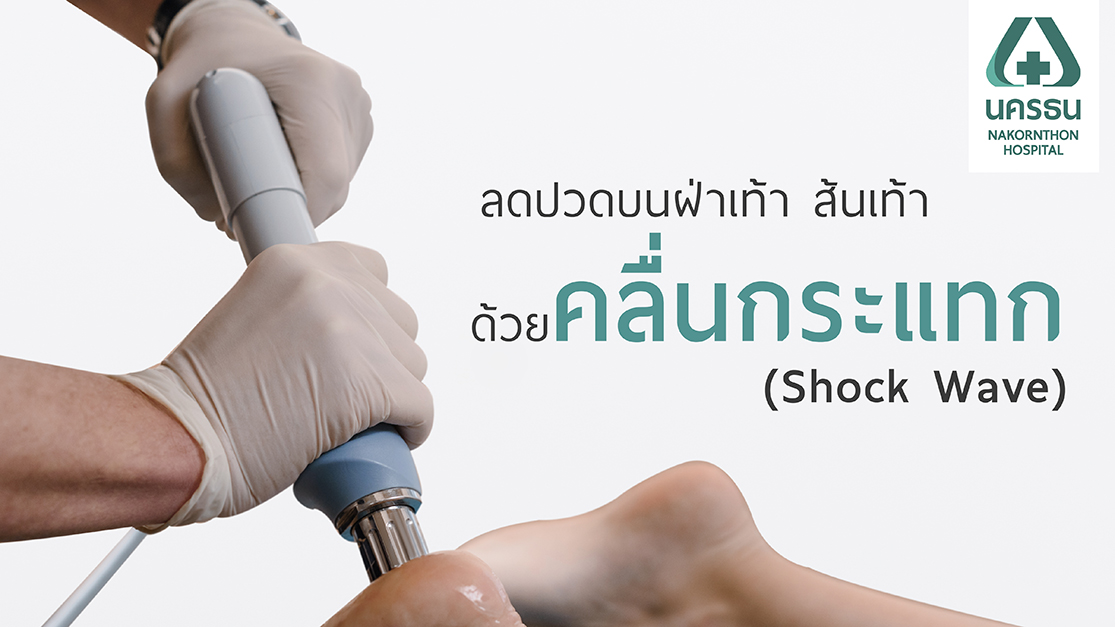 ปวดฝ่าเท้า ส้นเท้าจากโรครองช้ำ รักษาด้วยคลื่นกระแทก (Shock Wave)